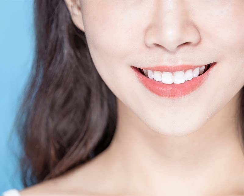 自鎖式系統齒顎矯正