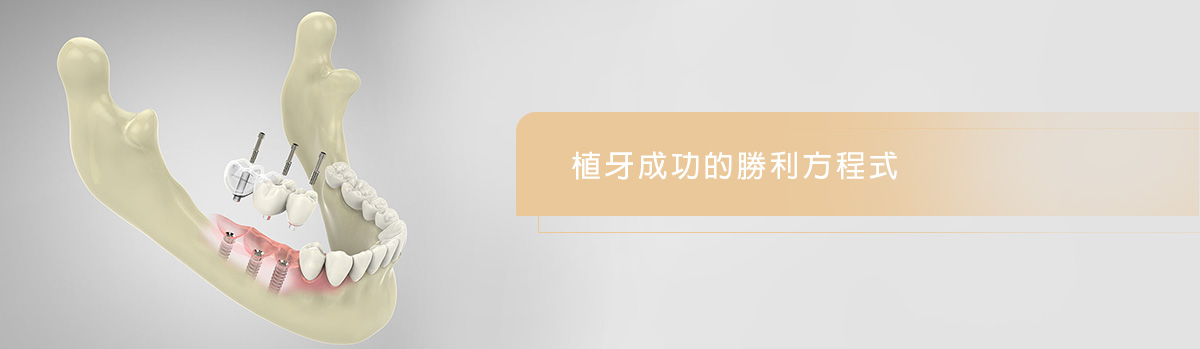 4D高階微創植牙 4D高階微創植牙