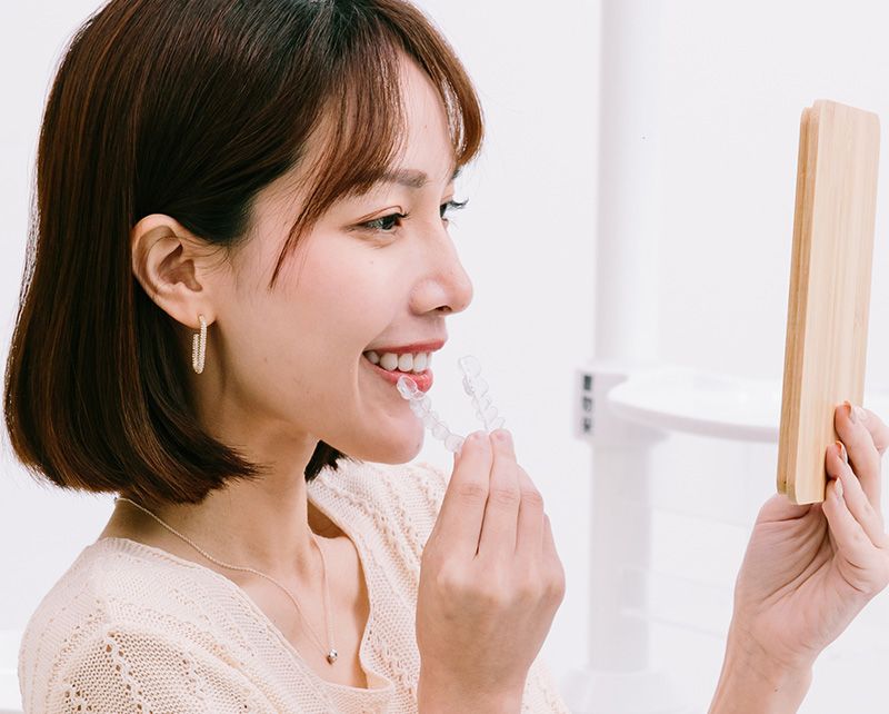 隱形美齒矯正 隱形美齒矯正